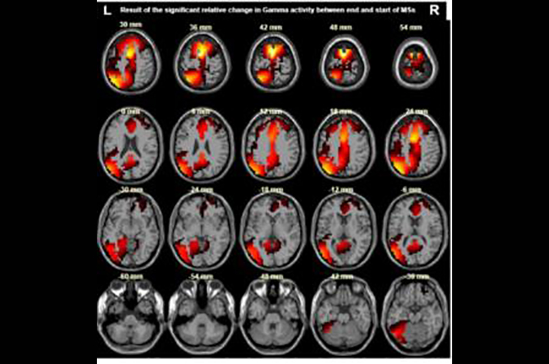 Brain during microsleep