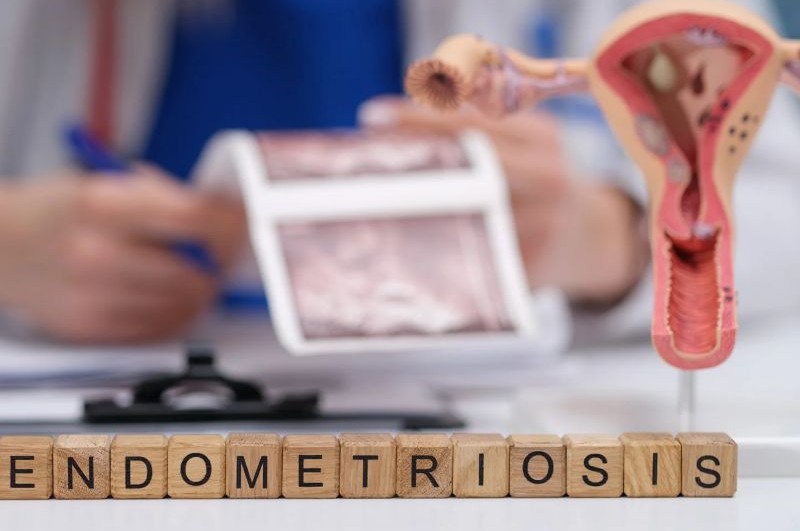 endometriosis graphic