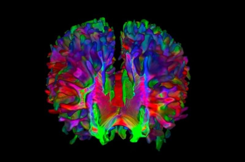 Brain scan
