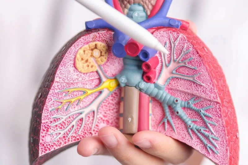 model of lungs