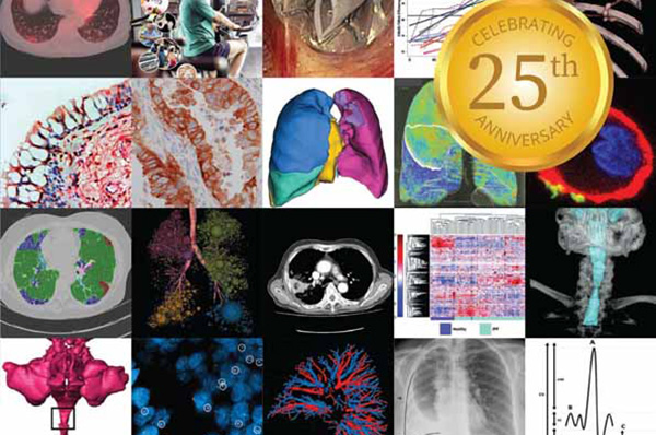 Cover image of Respirology journal