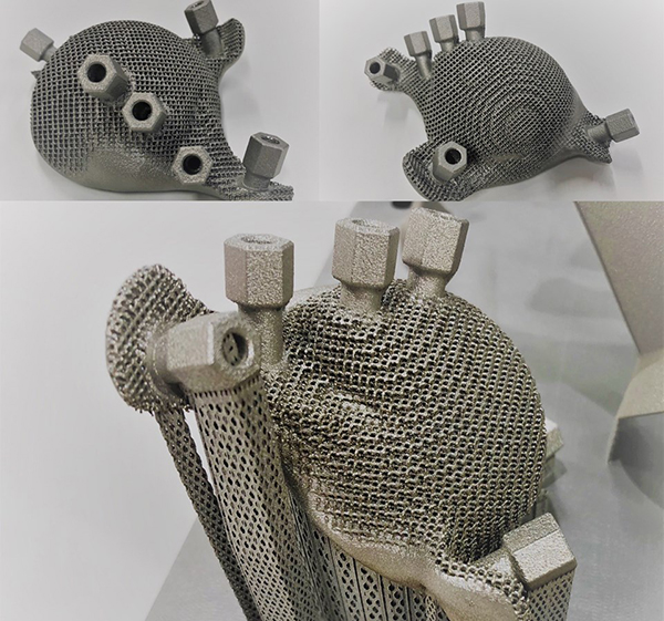 titanium hip replacement