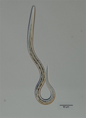 gut worm