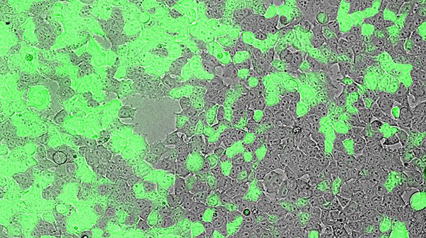 lung cells model