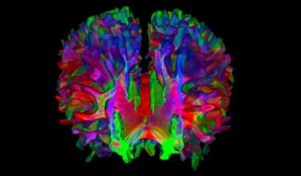 brain scan